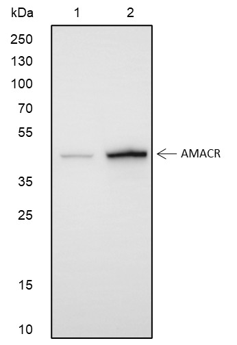 Recombinant AMACR Monoclonal Antibody - 2