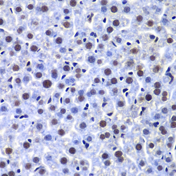Immunohistochemistry of paraffin-embedded Mouse liver using PRKDC Polyclonal Antibody at dilution of 1:100 (40x lens).