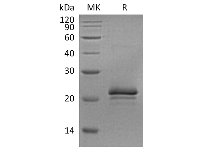 Recombinant Rat VEGF-A/VEGF164 Protein