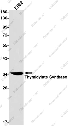 Recombinant Thymidylate Synthase Monoclonal Antibody - 1