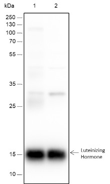 Recombinant Luteinizing Hormone beta Monoclonal Antibody-searchlist-1