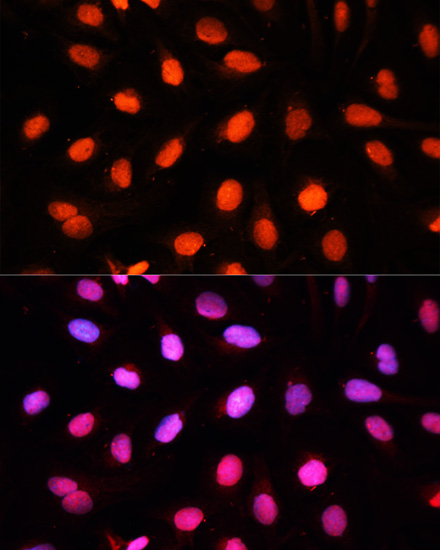 Immunofluorescence analysis of U2OS cells using NSUN2 Polyclonal Antibody at dilution of  1:100. Blue: DAPI for nuclear staining.