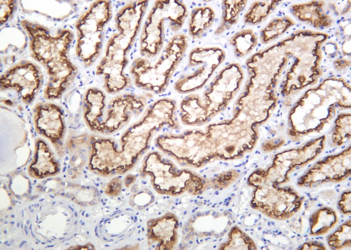 Recombinant BNIP-3 Monoclonal Antibody - small - 2