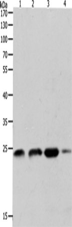 Western Blot analysis of K562, 231 and Hela cell, Human fetal brain tissue using RHOA Polyclonal Antibody at dilution of 1:400