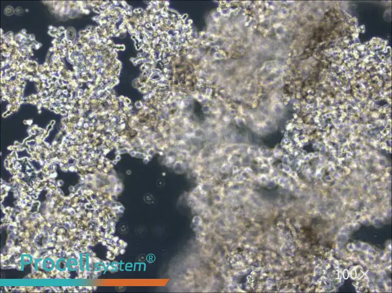 NCI-H526 Cell Complete Medium - 1