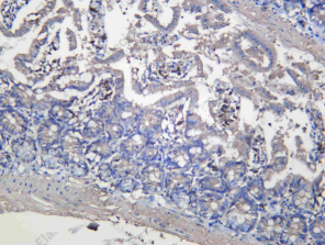Recombinant TIA1 Monoclonal Antibody - 1