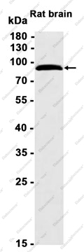 Recombinant Epsin 1 Monoclonal Antibody - 1