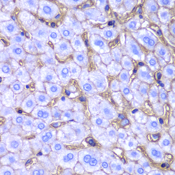 Immunohistochemistry of paraffin-embedded human liver damage using HLA-A Polyclonal Antibody at dilution of 1:100 (40x lens).Perform microwave antigen retrieval with 10 mM PBS buffer pH 7.2 before commencing with IHC staining protocol.