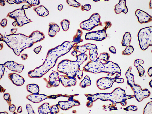 Immunohistochemistry of paraffinembedded Human placental tissue with CD105 Monoclonal Antibody(Antigen repaired by EDTA).