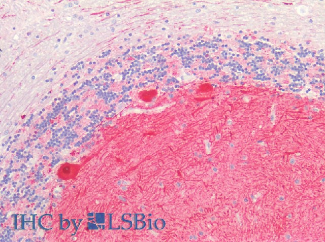 Immunohistochemistry of paraffin-embedded Human Cerebellum using GRIN2A Polyclonal Antibody at dilution of 1:50(Elabscience Product Detected by Lifespan).