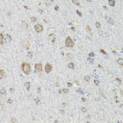 Immunohistochemistry of paraffin-embedded rat brain using MTHFD1L Polyclonal Antibody at dilution of 1:200 (40x lens).Perform high pressure antigen retrieval with 10 mM citrate buffer pH 6.0 before commencing with IHC staining protocol.