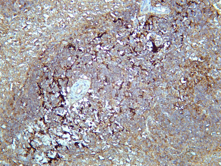 Recombinant SQSTM1/p62 Monoclonal Antibody - 5