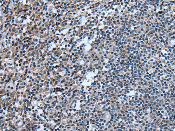 Immunohistochemistry of paraffin-embedded Human tonsil tissue  using UGT8 Polyclonal Antibody at dilution of 1:55(?200)