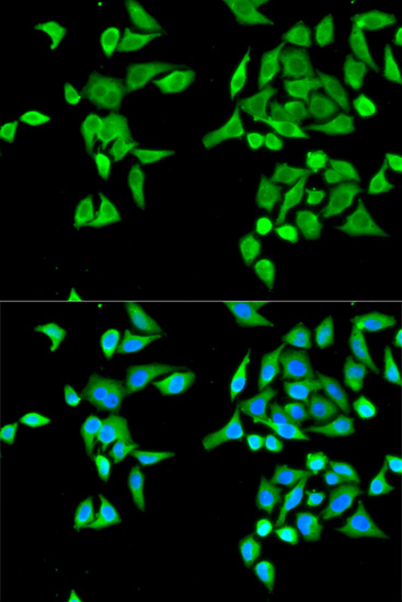 Immunofluorescence analysis of MCF-7 cells using CES2 Polyclonal Antibody Blue: DAPI for nuclear staining.