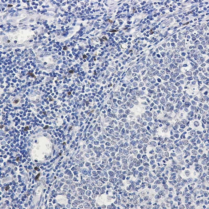 Immunohistochemistry of IL-26 in paraffin-embedded Human tonsil using IL-26 Rabbit mAb at dilution 1:50