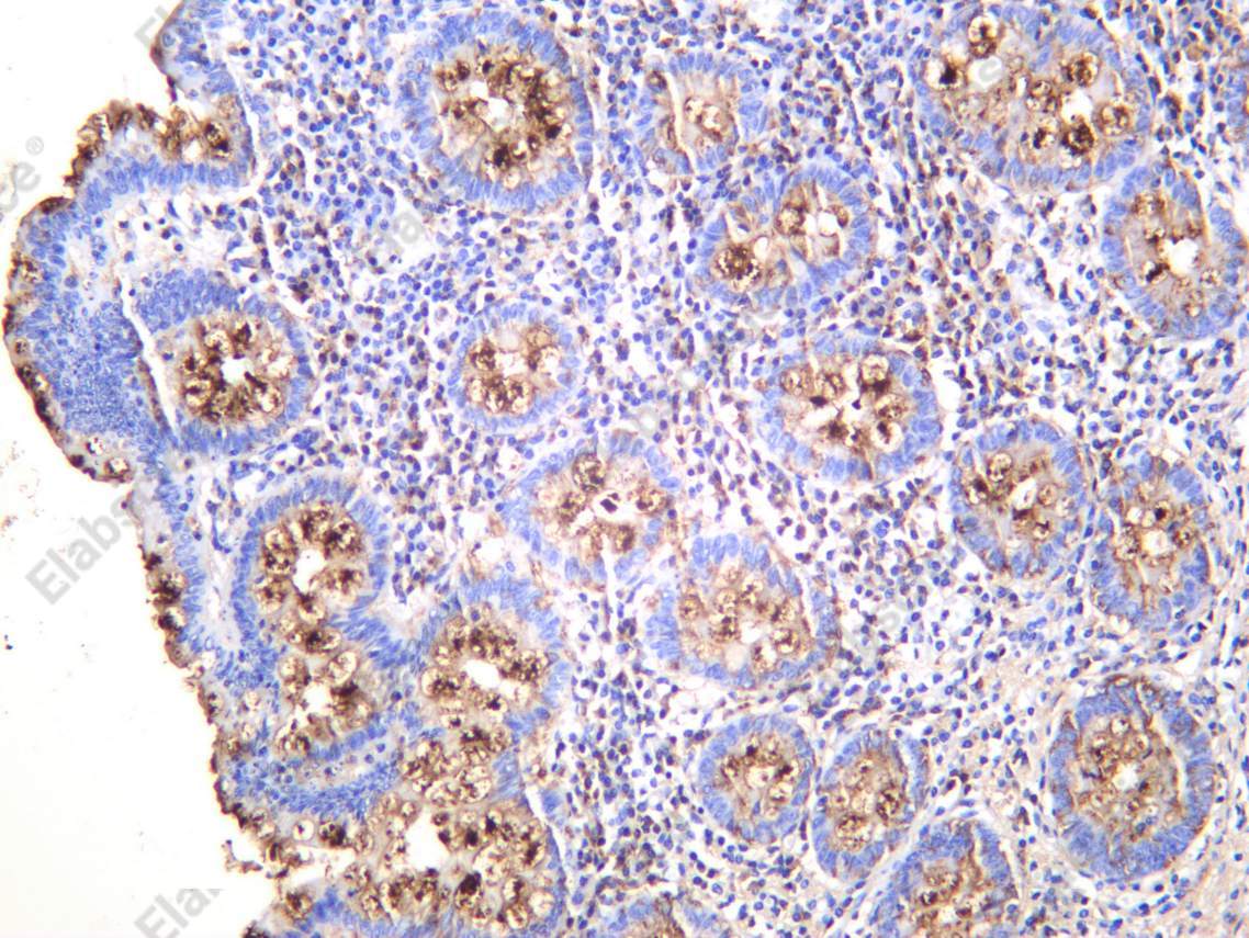 Recombinant SPAK Monoclonal Antibody - 1