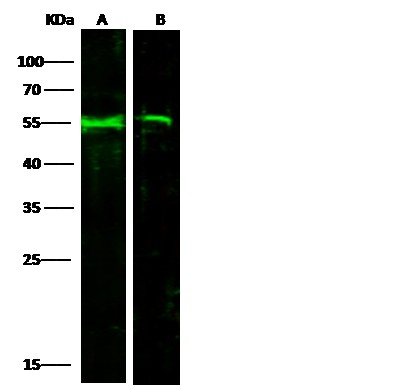 Recombinant Coagulation Factor IX/FIX/F9 Monoclonal Antibody - small - 2