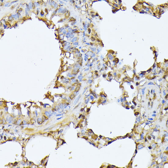 Immunohistochemistry of paraffin-embedded Rat lung using PSMB3 Polyclonal Antibody at dilution of  1:100 (40x lens).