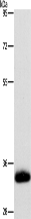 Western Blot analysis of Human testis tissue using AMBP Polyclonal Antibody at dilution of 1:500