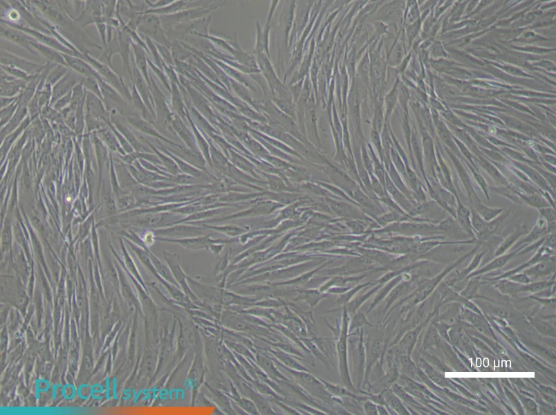 Human Endometrial Stromal Cell Complete Medium - 1