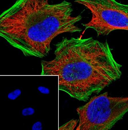 Recombinant Gelsolin Monoclonal Antibody-searchlist-2