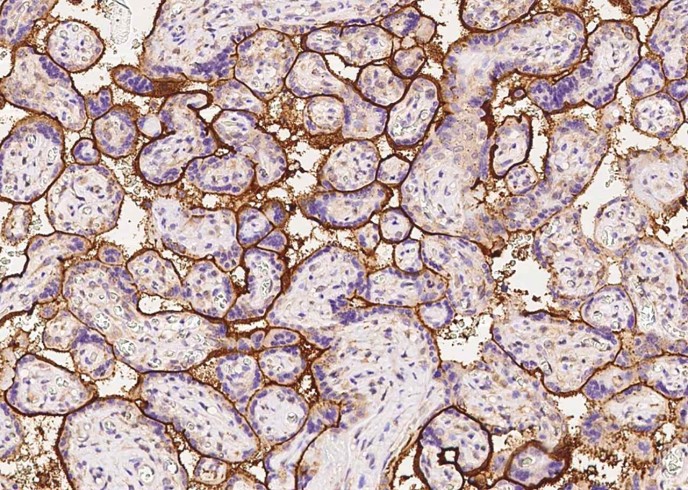 Recombinant Syndecan-1/SDC1 Monoclonal Antibody - small - 2