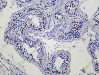 Recombinant MACROH2A1 Monoclonal Antibody - 2
