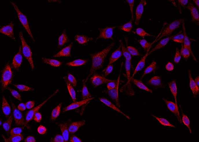 Recombinant Gastric intrinsic factor/GIF Monoclonal Antibody - small - 2