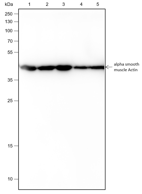 Recombinant alpha smooth muscle Actin Monoclonal Antibody-searchlist-1