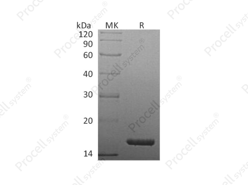 TNF-&alpha;/TNFA/TNFSF2, Human, Recombinant
