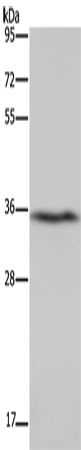 Western Blot analysis of Human fetal liver tissue using DDAH1 Polyclonal Antibody at dilution of 1:400