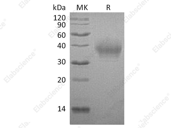 Recombinant Rabbit B7-1/CD80 Protein (His Tag) - 1