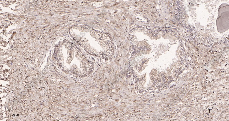 Recombinant LC3A Monoclonal Antibody - 2