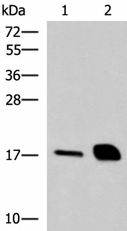 Western blot analysis of Mouse pancreas tissue and Rat pancreas tissue lysates  using RNASE1 Polyclonal Antibody at dilution of 1:550