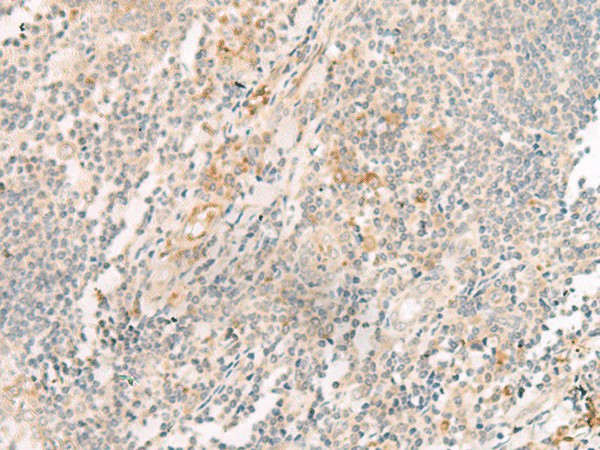 Immunohistochemistry of paraffin-embedded Human tonsil tissue  using HBE1 Polyclonal Antibody at dilution of 1:30(?200)