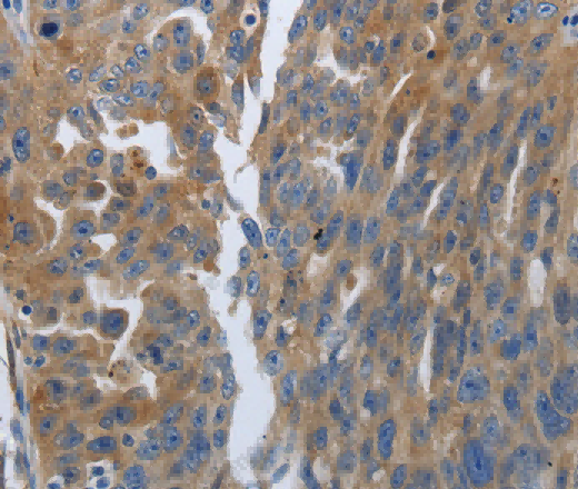 SOCS1 Polyclonal Antibody - 2