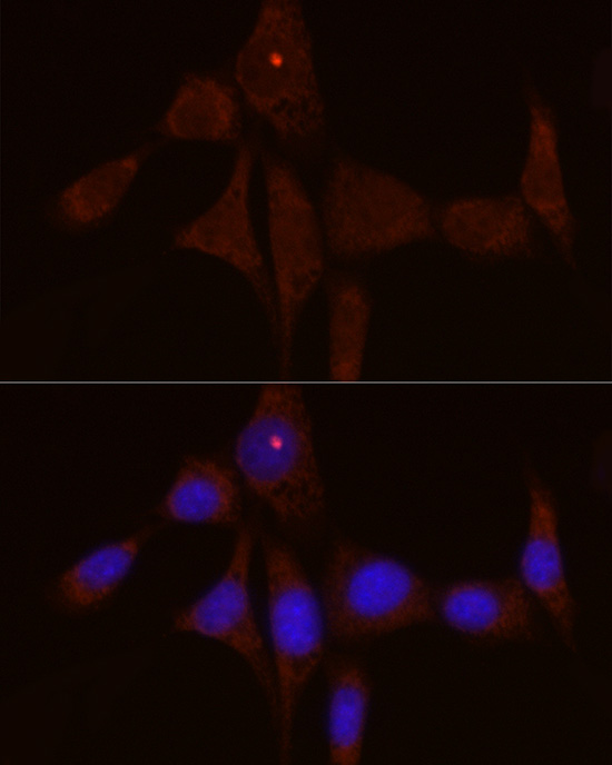 Immunofluorescence analysis of NIH/3T3 cells using IL1RN Polyclonal Antibody at dilution of 1:50 (40x lens). Blue: DAPI for nuclear staining.