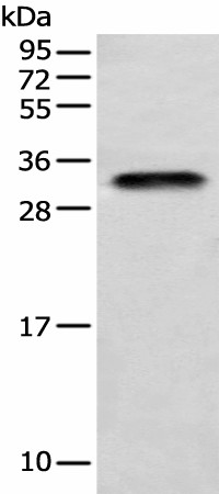 Western blot analysis of Human testis tissue  using LYPD4 Polyclonal Antibody at dilution of 1:400