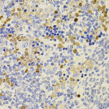 Immunohistochemistry of paraffin-embedded Rat spleen using PRDM5 Polyclonal Antibody at dilution of 1:100 (40x lens).