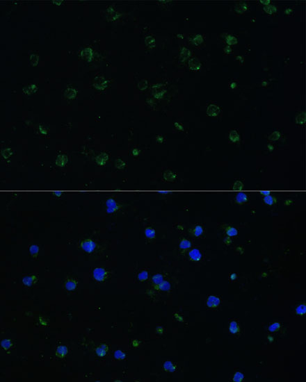 Immunofluorescence analysis of Jurkat cells using ARHGAP25 Polyclonal Antibody at dilution of 1:100 (40x lens). Blue: DAPI for nuclear staining.