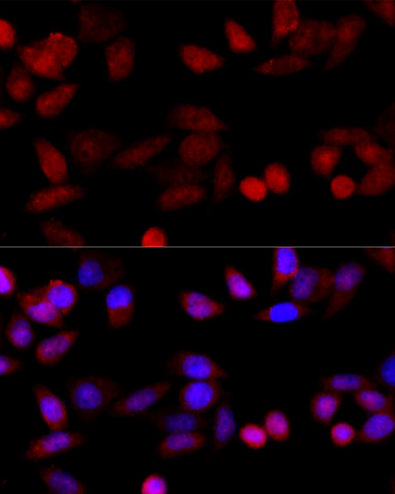 Immunofluorescence analysis of HeLa cells using CYP1B1 Polyclonal Antibody at dilution of 1:100 (40x lens). Blue: DAPI for nuclear staining.