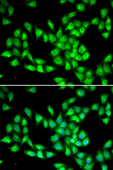 Immunofluorescence analysis of HeLa cells using PCMT1 Polyclonal Antibody