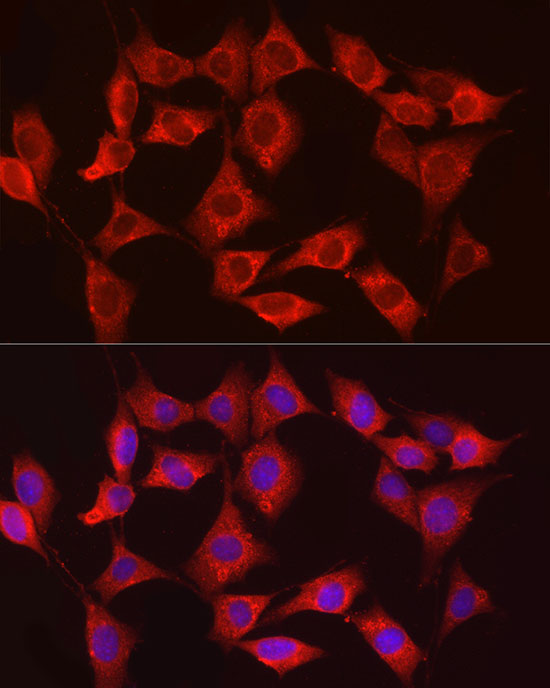 Immunofluorescence analysis of NIH/3T3 cells using HK3 Polyclonal antibody at dilution of 1:150 (40x lens). Blue: DAPI for nuclear staining.