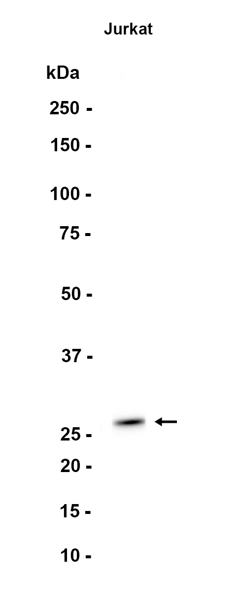 Recombinant UCHL3 Monoclonal Antibody - 1