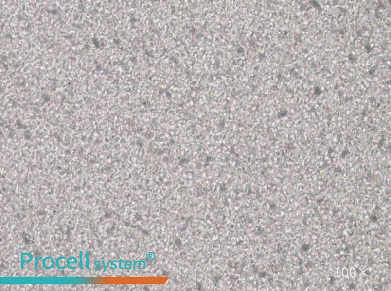 SU-DHL-1 Cell Complete Medium - 3