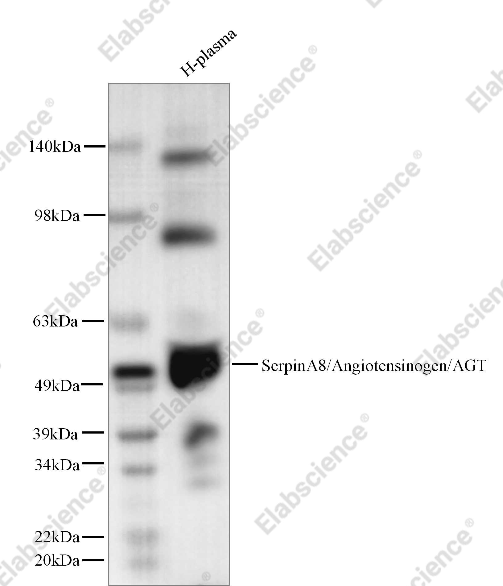 Recombinant SerpinA8/Angiotensinogen/AGT Monoclonal Antibody - 1