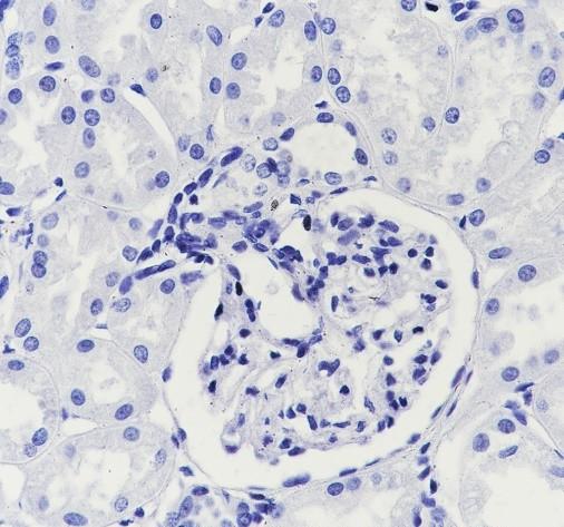Recombinant SLC45A3 Monoclonal Antibody - 3