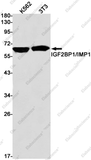 Recombinant IGF2BP1 Monoclonal Antibody - 1