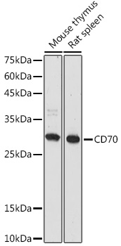 Western blot analysis of extracts of various cell lines using CD70 Polyclonal Antibody at 1:1000 dilution.