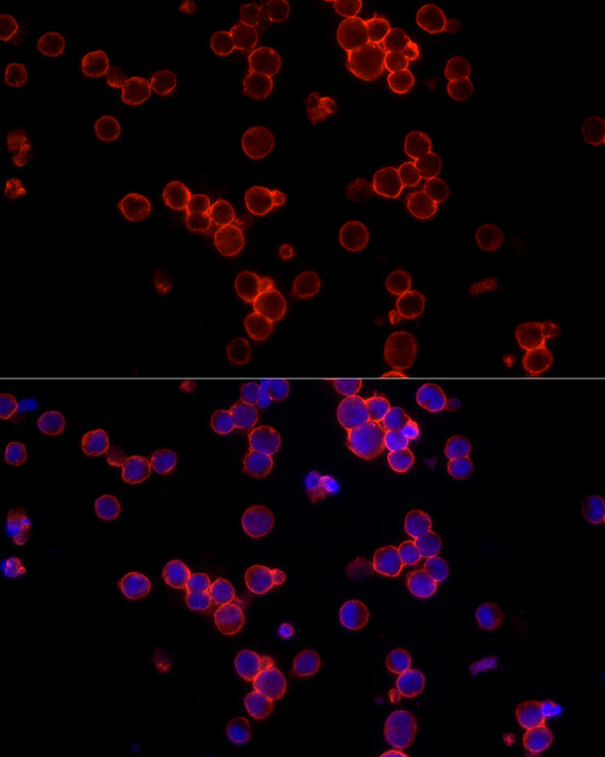 Immunofluorescence analysis of Raji cells using CD19 Polyclonal Antibody at dilution of 1:100 (40x lens). Blue: DAPI for nuclear staining.